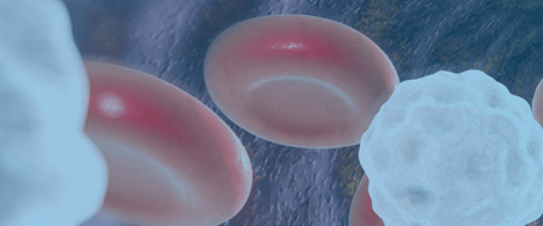 atherosclerosis-signs